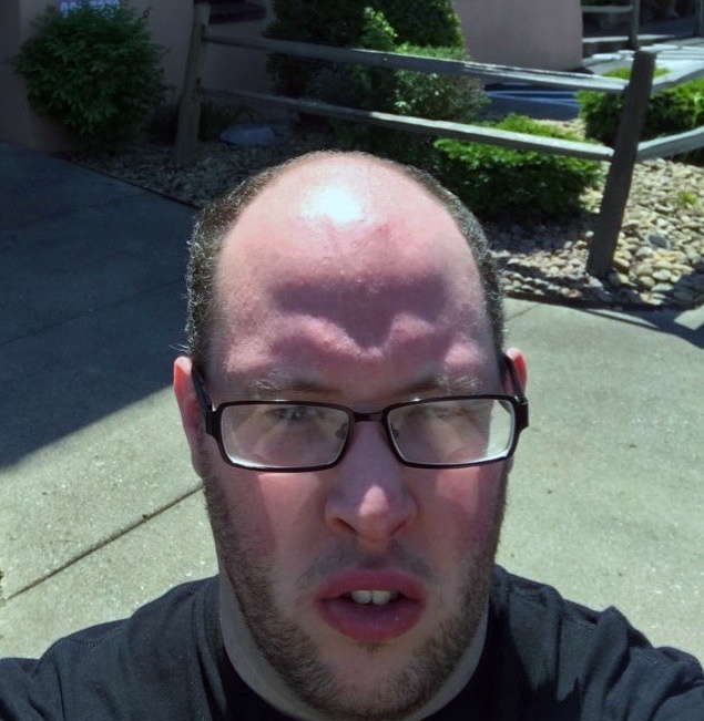 Personal Stories | The Association for X and Y Chromosome Variations